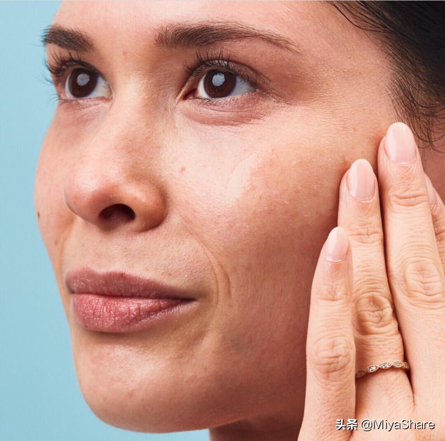 皮肤营养过剩的症状,营养过剩皮肤会过敏是什么原因