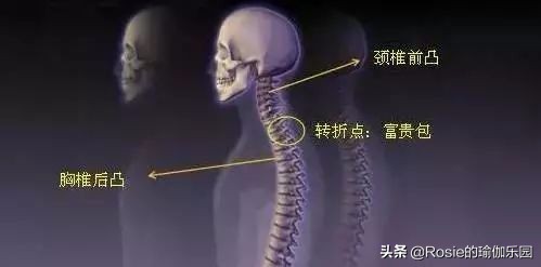 富贵包快速消除背部方法,为什么背有富贵包