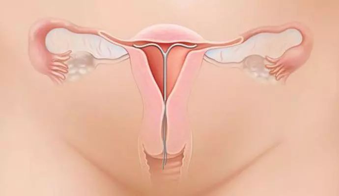 吃完紧急避孕药这个月怀孕的概率,吃了紧急避孕药也怀孕了