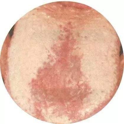 胃病怎么得来的,胃病都是怎么来的