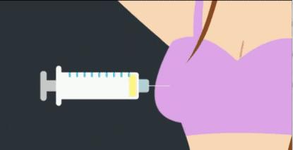 丰胸最新技术,最新丰胸秘籍不反弹