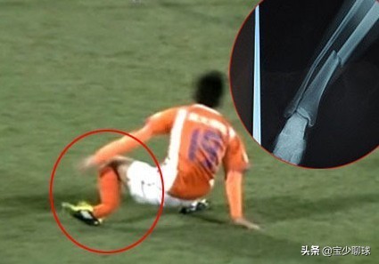 职业联赛处罚合法吗,职业联赛打人事件