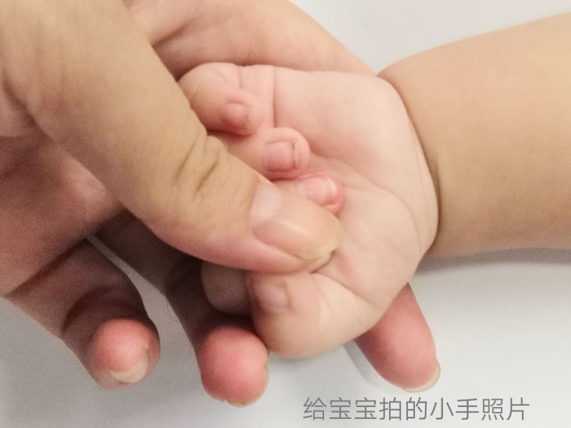 新生儿牛奶蛋白过敏如何转奶,新生儿牛奶蛋白过敏拉血多久能好