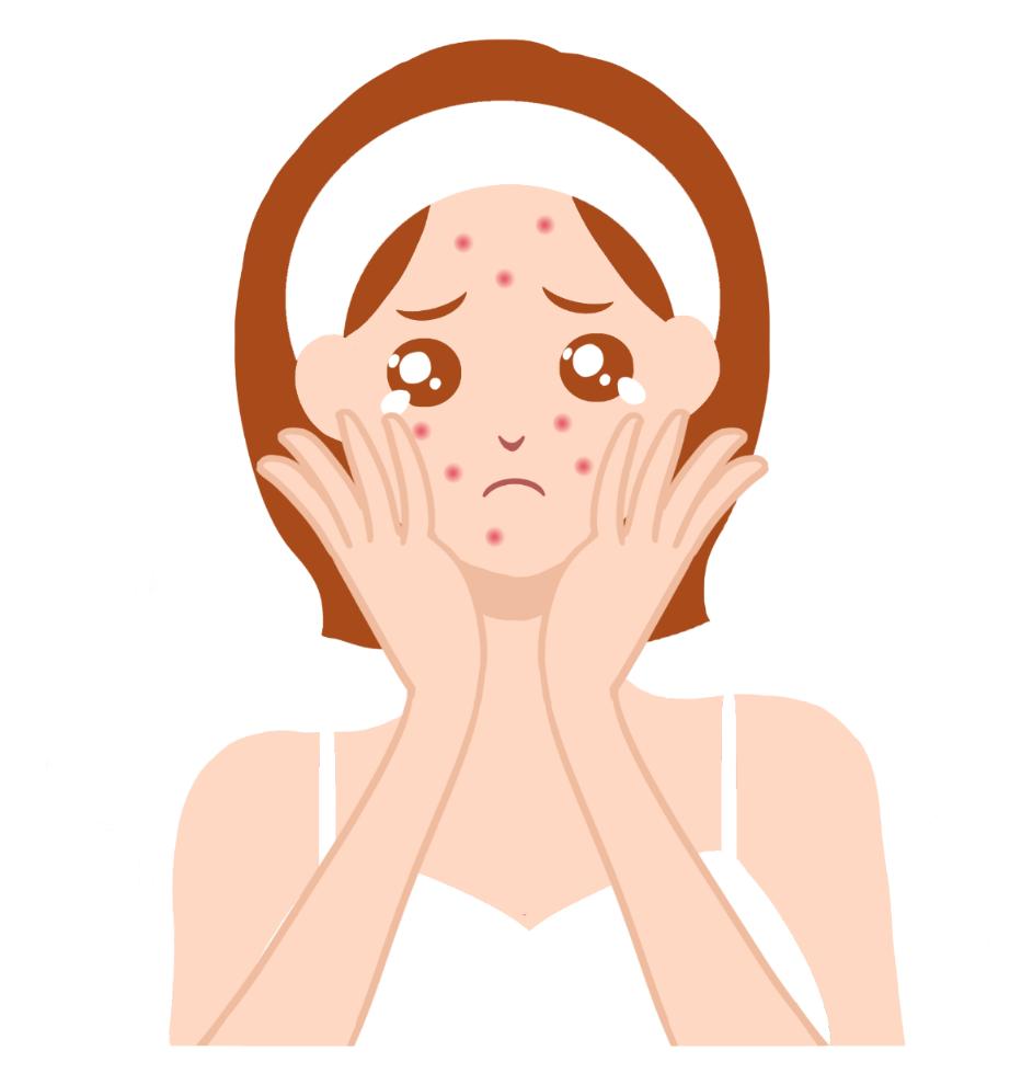 脸上有痘拍婚纱怎么办,要拍婚纱照了脸上长痘了怎么办