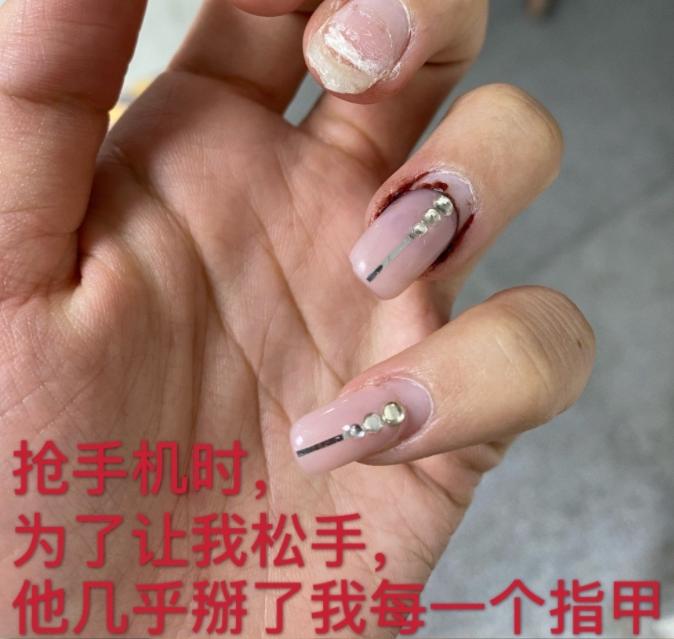 张培萌100米跑赢苏炳添,张培萌飞人事件