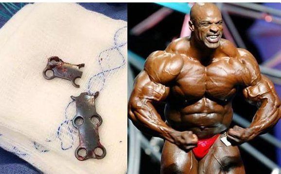 健美运动员意外去世,奥赛健美哪位选手去世了