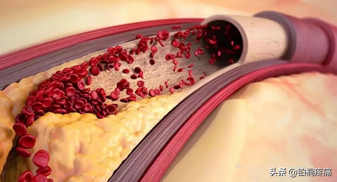 超氧自体血回输疗法是治什么病的,三氧自体血回输疗法简介