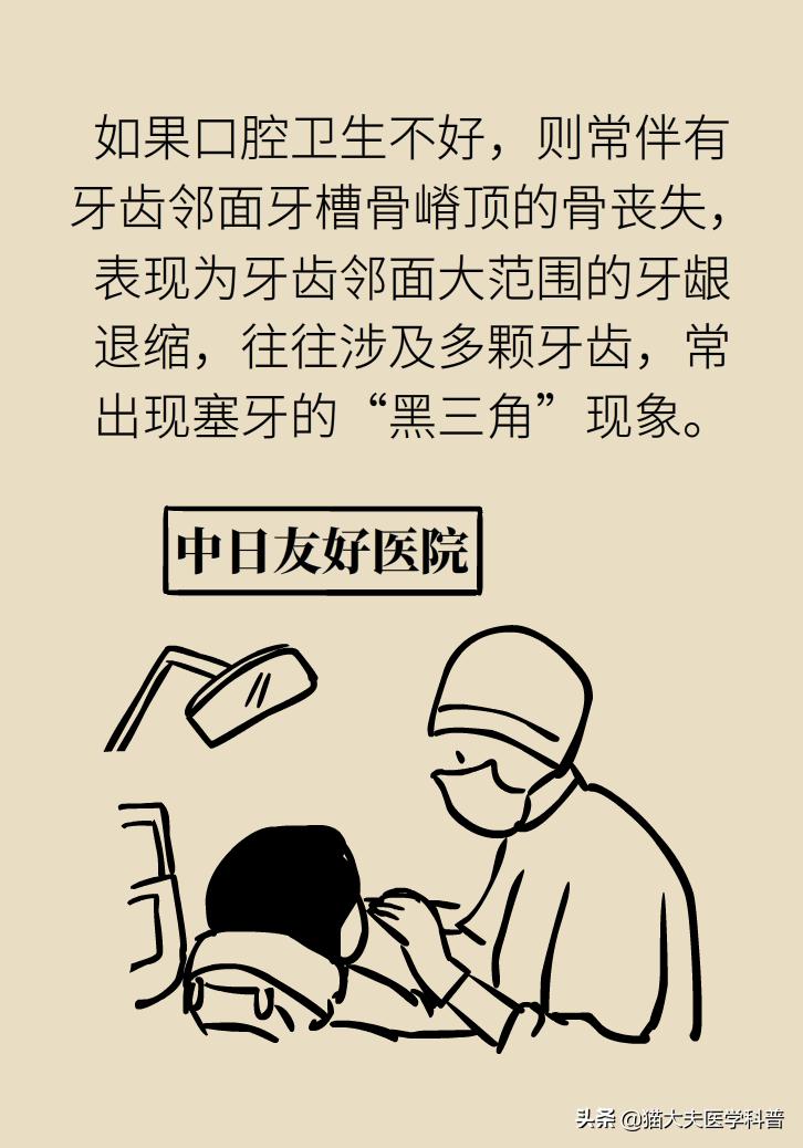 牙根暴露了该怎么刷牙,牙根治疗后可以刷牙吗