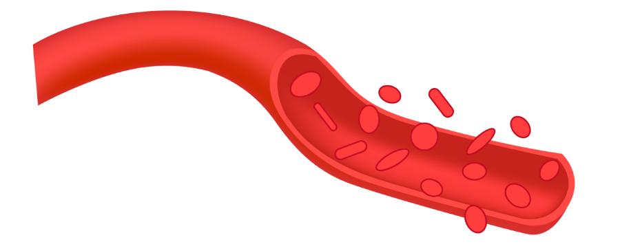 艾灸灸透了是什么感觉和表现,大家都在说的宣什么意思