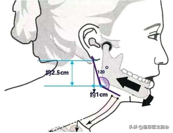 好看的脸型下颌角,120度的下颚角什么样