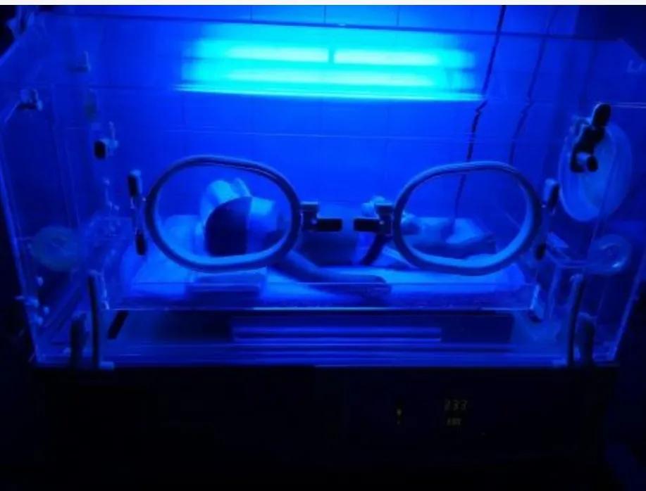 新生儿常见的皮肤问题,新生儿心脏血管常见问题