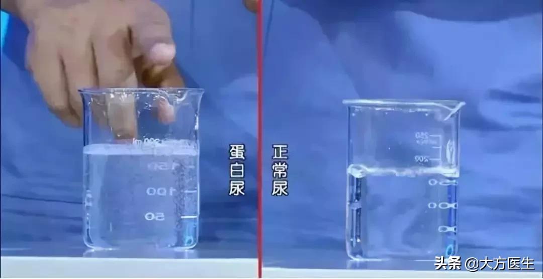 肿瘤标志物10项指标,肝功能10项指标参考