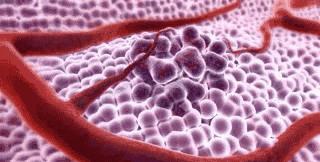 癌症与衰老有关吗,癌症跟肥胖有关系吗