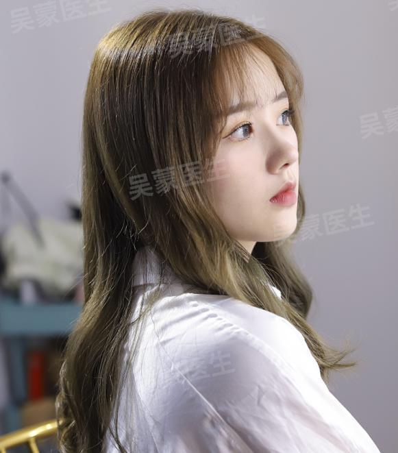 鞠婧祎鼻子整过吗,鞠婧祎的鼻子整过吗