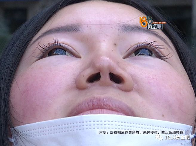 三年动刀三次,老公说她整得跟“猪”一样?