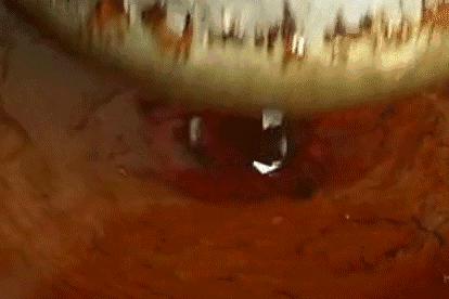 小小的芝麻，为什么营养师也粉它？