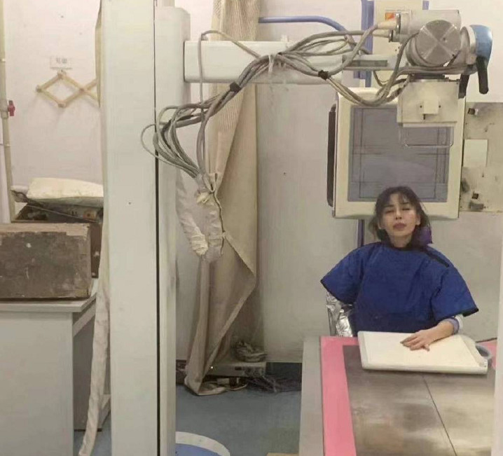 baby跑男口红,跑男中的baby受伤的视频