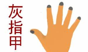 灰指甲最好的药,小小年纪得灰指甲