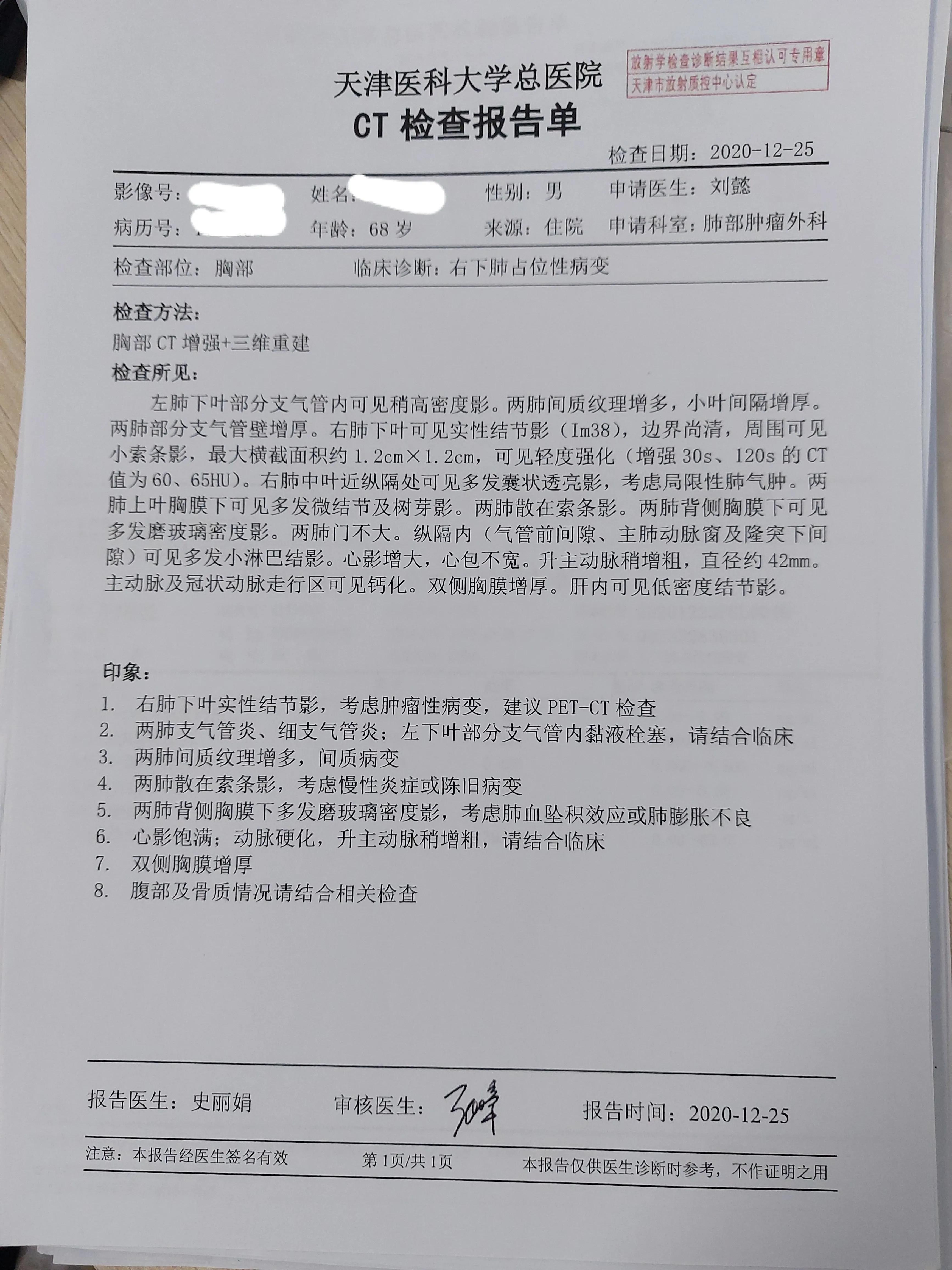 七种自身抗体检测肺癌正常指标,刘懿博士说肺癌免疫治疗