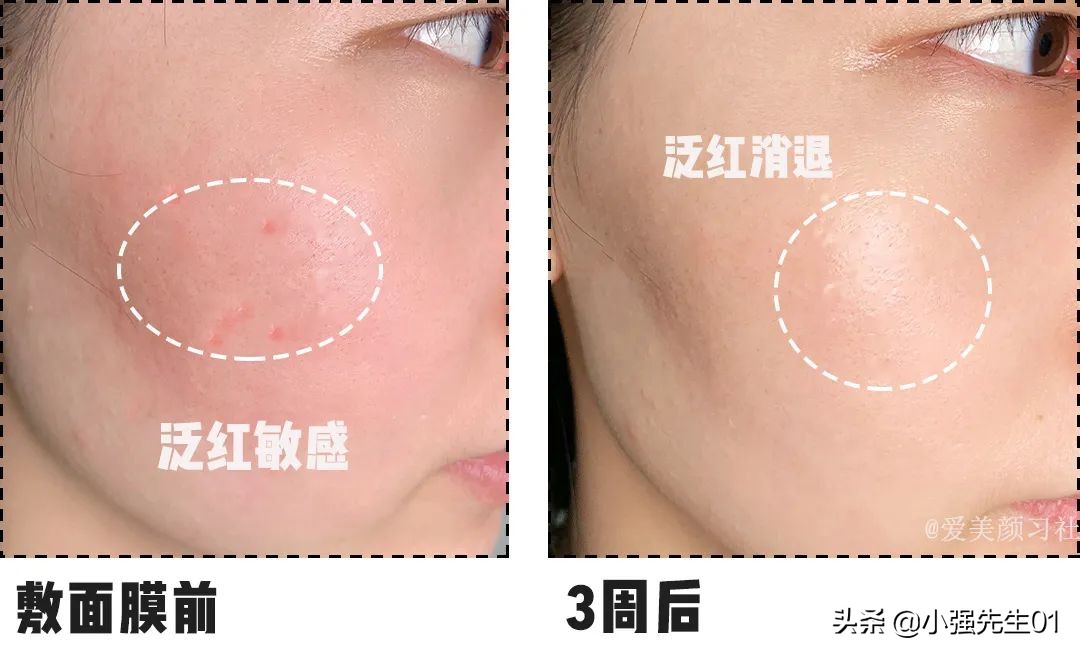 看完这些廉价面膜你还敢买吗,便宜又烂脸的面膜有哪些