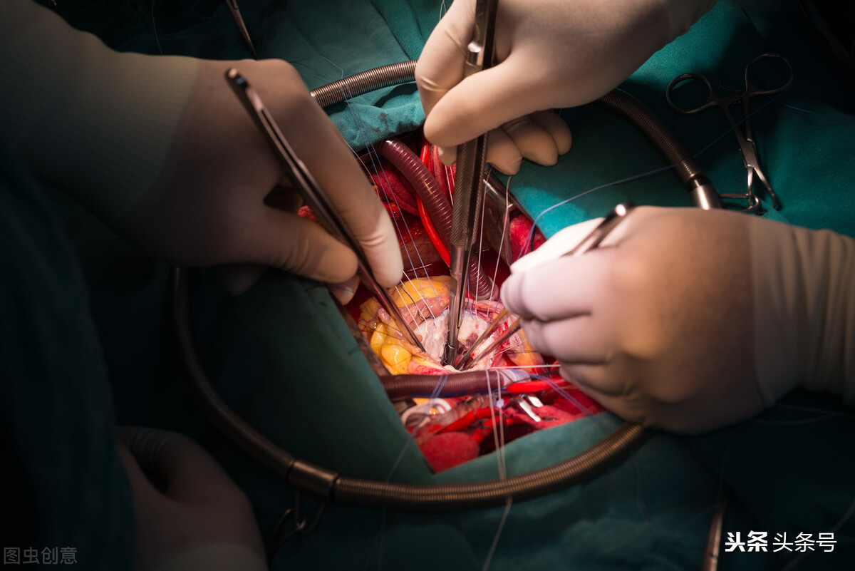 心脏瓣膜轻度反流喝中药能好么,心脏瓣膜反流可以治愈吗