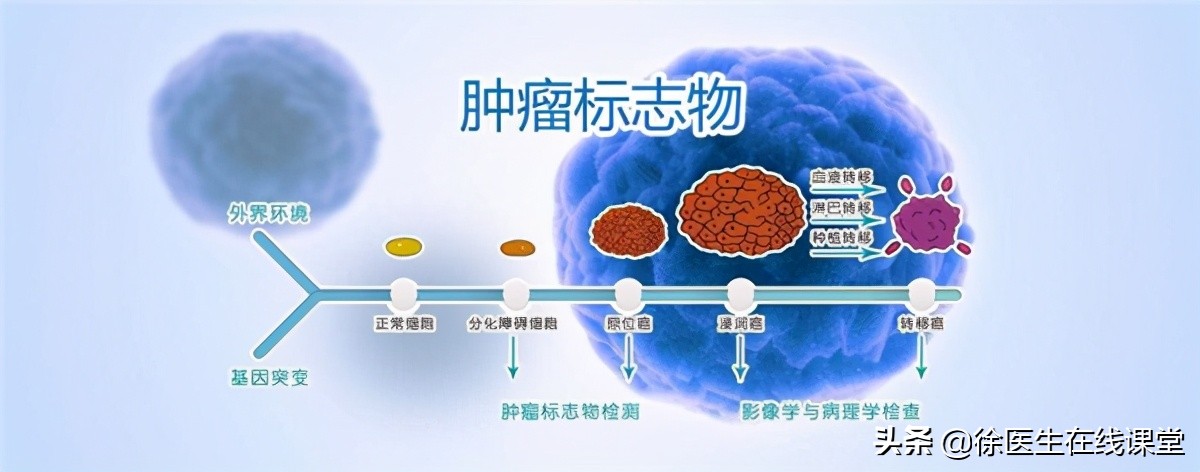 腹痛，肿瘤标志物高出几十倍，却查不出病因，这该怎么办？