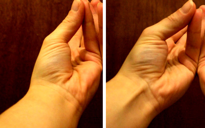 人体的变异,人体罕见变异现象排行榜