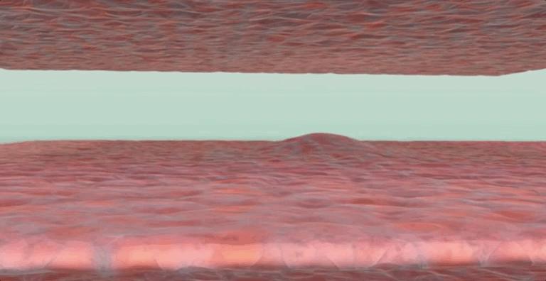 怎么恢复愈合伤口留下的疤痕,科普短片伤口是如何愈合的