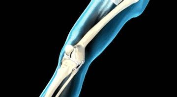 练拳的十大忌讳,练拳伤到骨头怎么办