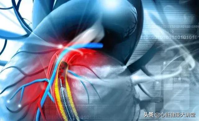 冠心病血栓最新治疗方法,冠心病形成血栓吃什么药