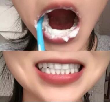 牙膏减少牙渍牙结石,去除牙菌斑清新口气牙膏