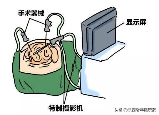 「硬核技术」男友为25岁“石女”寻医