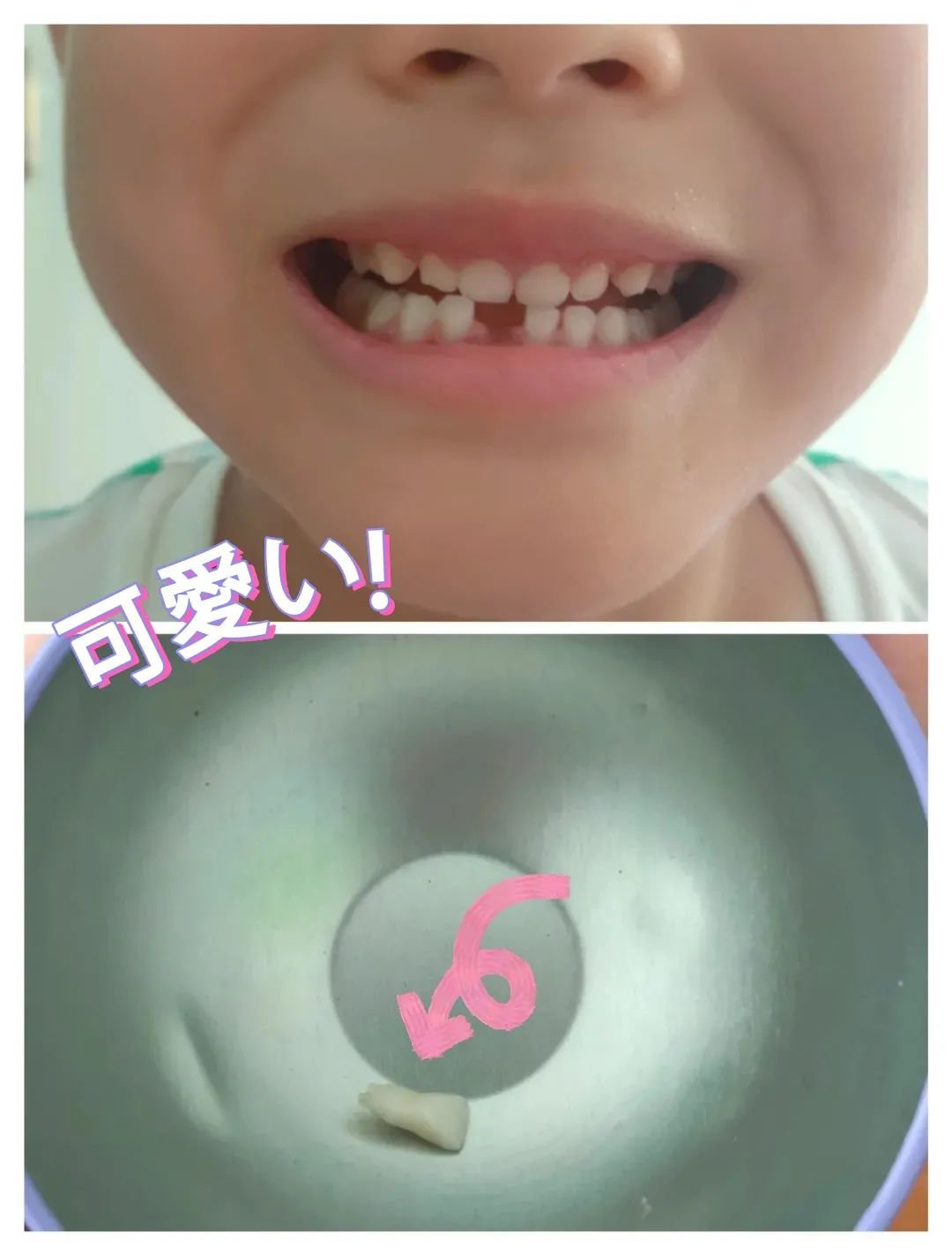 孩子7个多月出牙不愿意喝奶,小孩不长牙就会喊妈妈