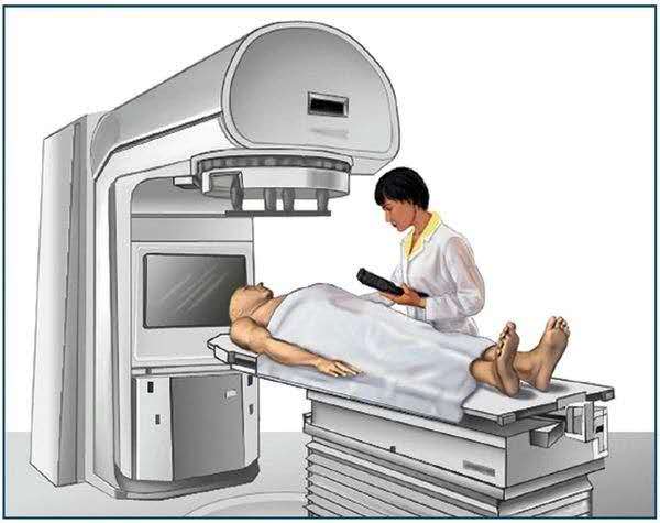 放射治疗什么意思,放射治疗是什么手段