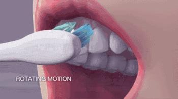 10岁儿童蛀牙怎么治疗最好,如何预防孩子蛀牙龋齿