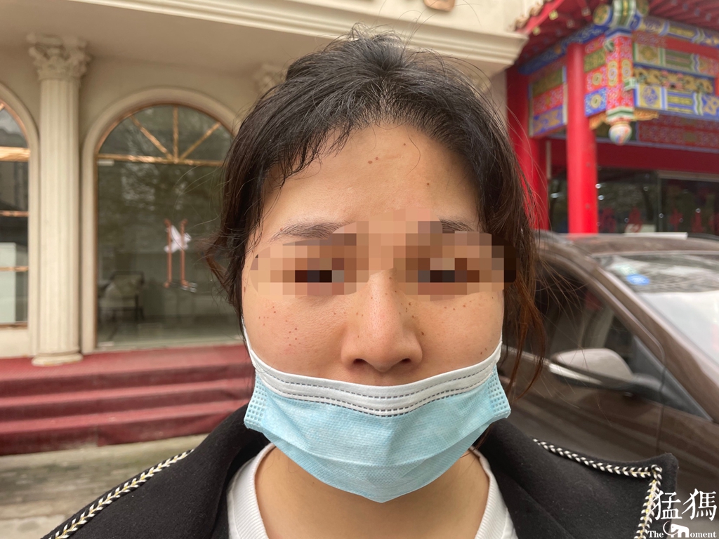 周口24岁女子花1.2万整鼻子,不料鼻子越来越大还发臭