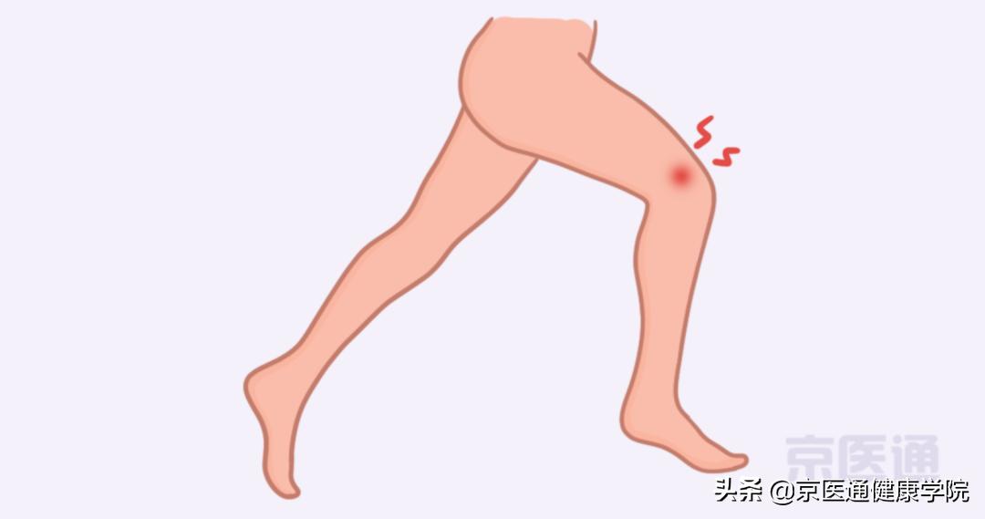 膝盖疼、腿疼、脚疼,5种跑步损伤,专家教你处理