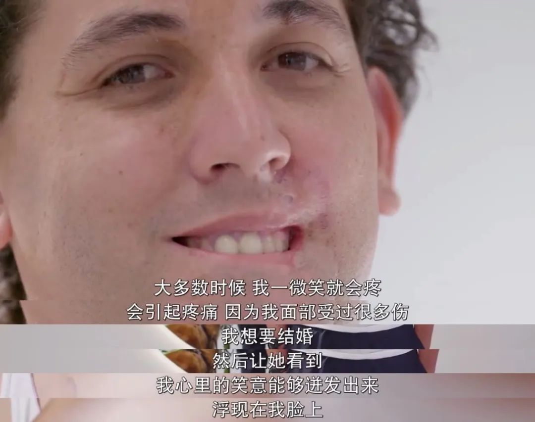 整容能弄成明星的样子吗,整容真的能整漂亮吗