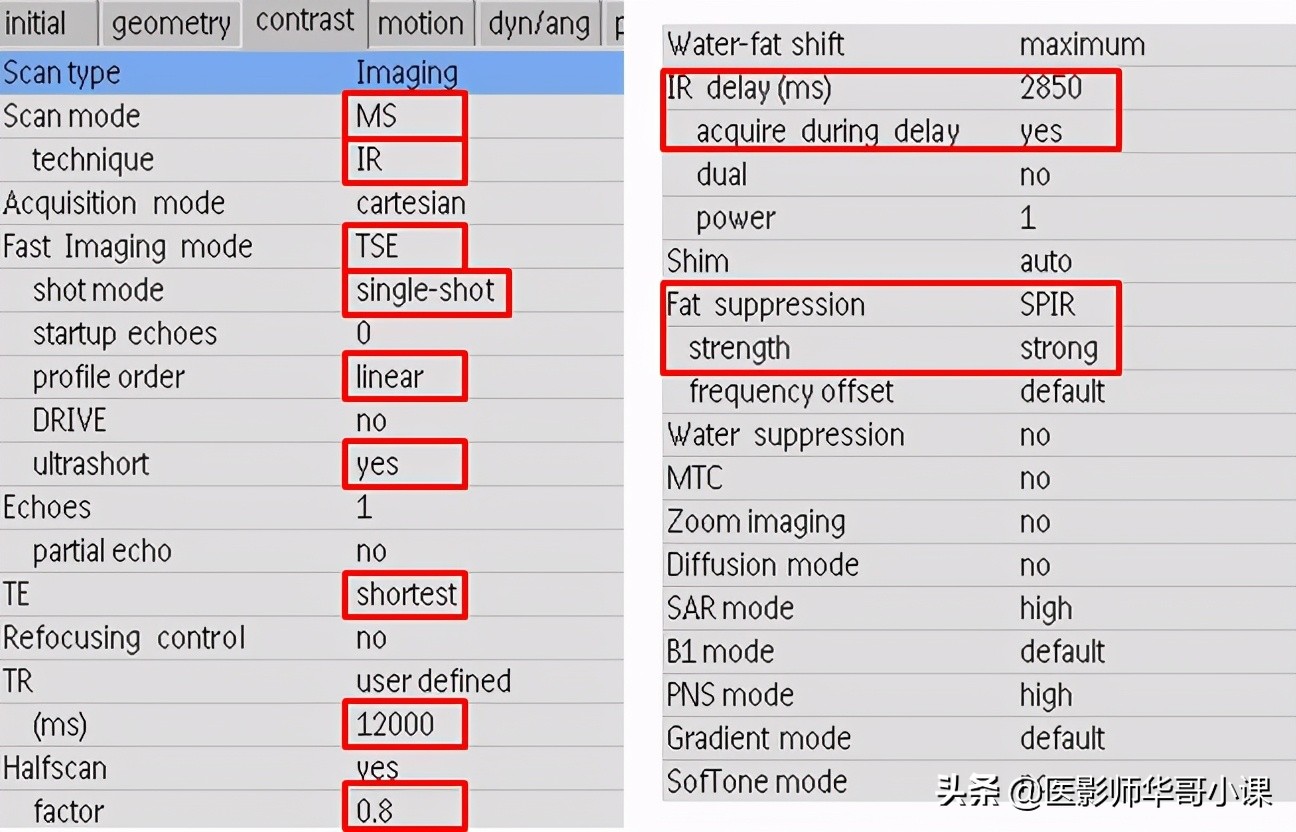 「MRI技术」磁共振伪影分析，了解下SSh_FLAIR序列