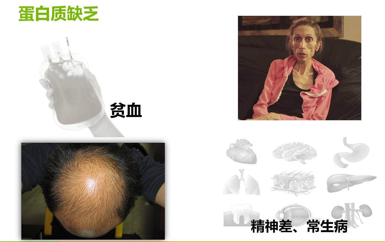 我们需要了解的蛋白质基础知识,蛋白质基础知识及应用法则