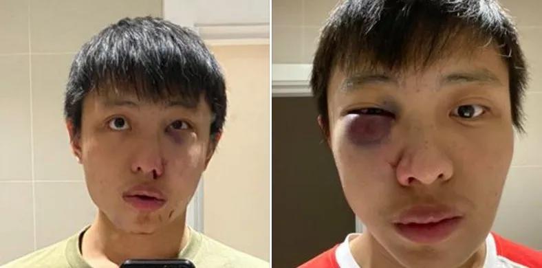 新加坡留学生在墨尔本街头遭暴打,中国留学生在澳大利亚当街遭暴打