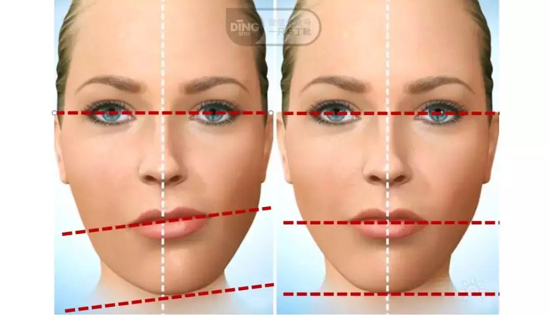 脸大小不对称怎么矫正,如何改善大小脸不对称