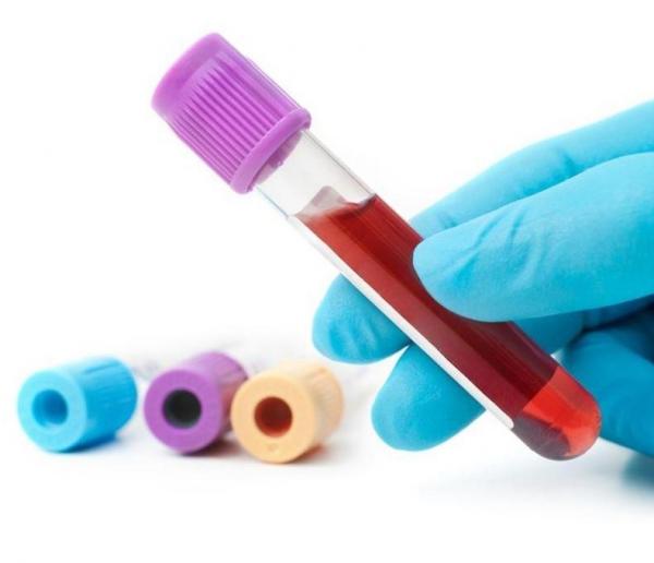 乙肝小三阳和大三阳严重程度比较,乙肝是大三阳好还是小三阳好