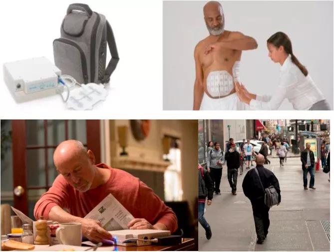 癌细胞电场疗法,内置电场杀死癌症细胞