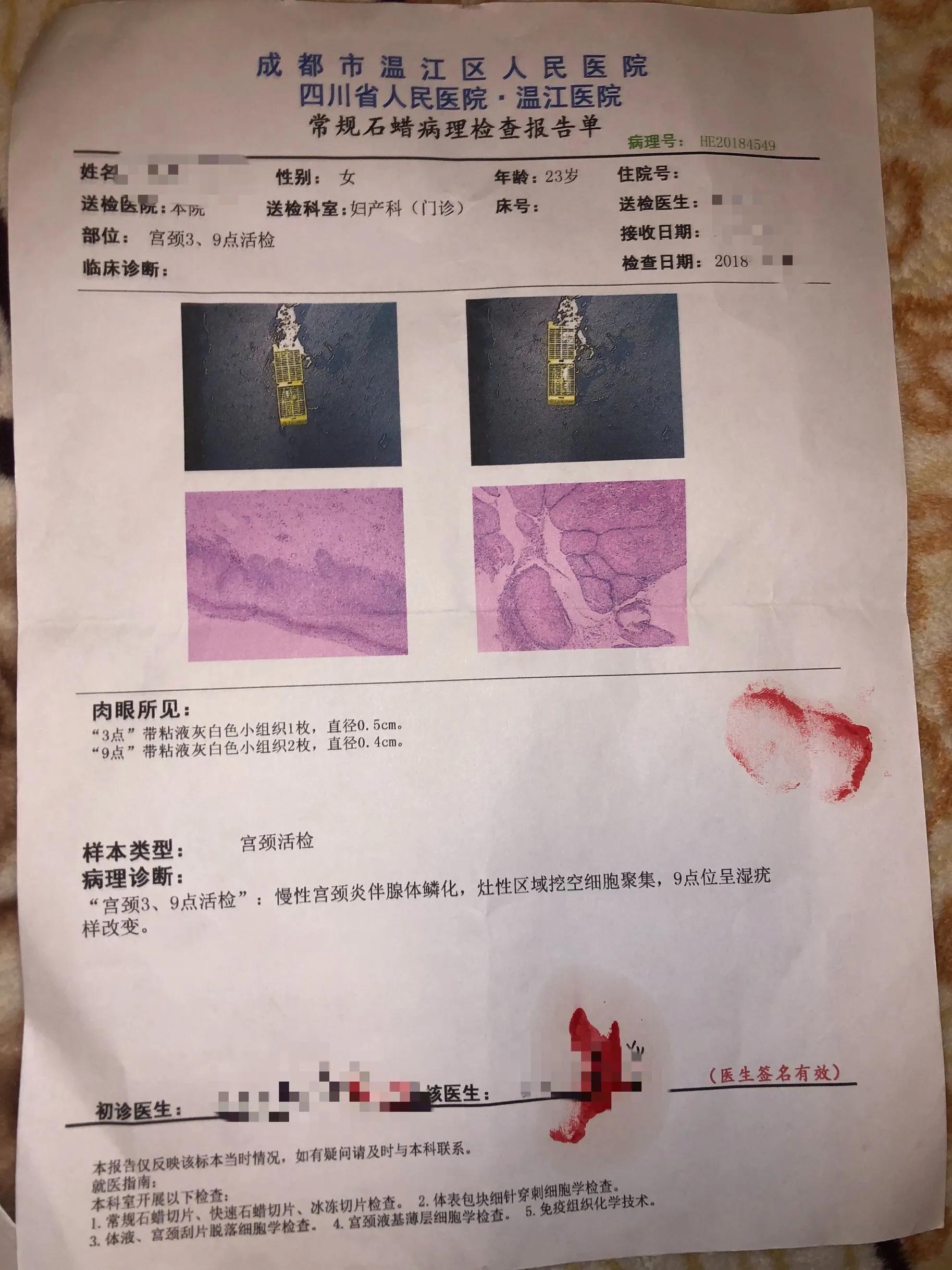 分享一下孕期HPV66转阴，各位携带者早发现早预防！！