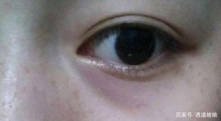 黑眼圈的自救指南有哪些,黑眼圈自救指南看这里