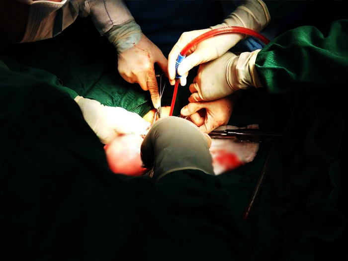 河南沈丘妇幼孕妇大出血,河南一名孕妇大出血