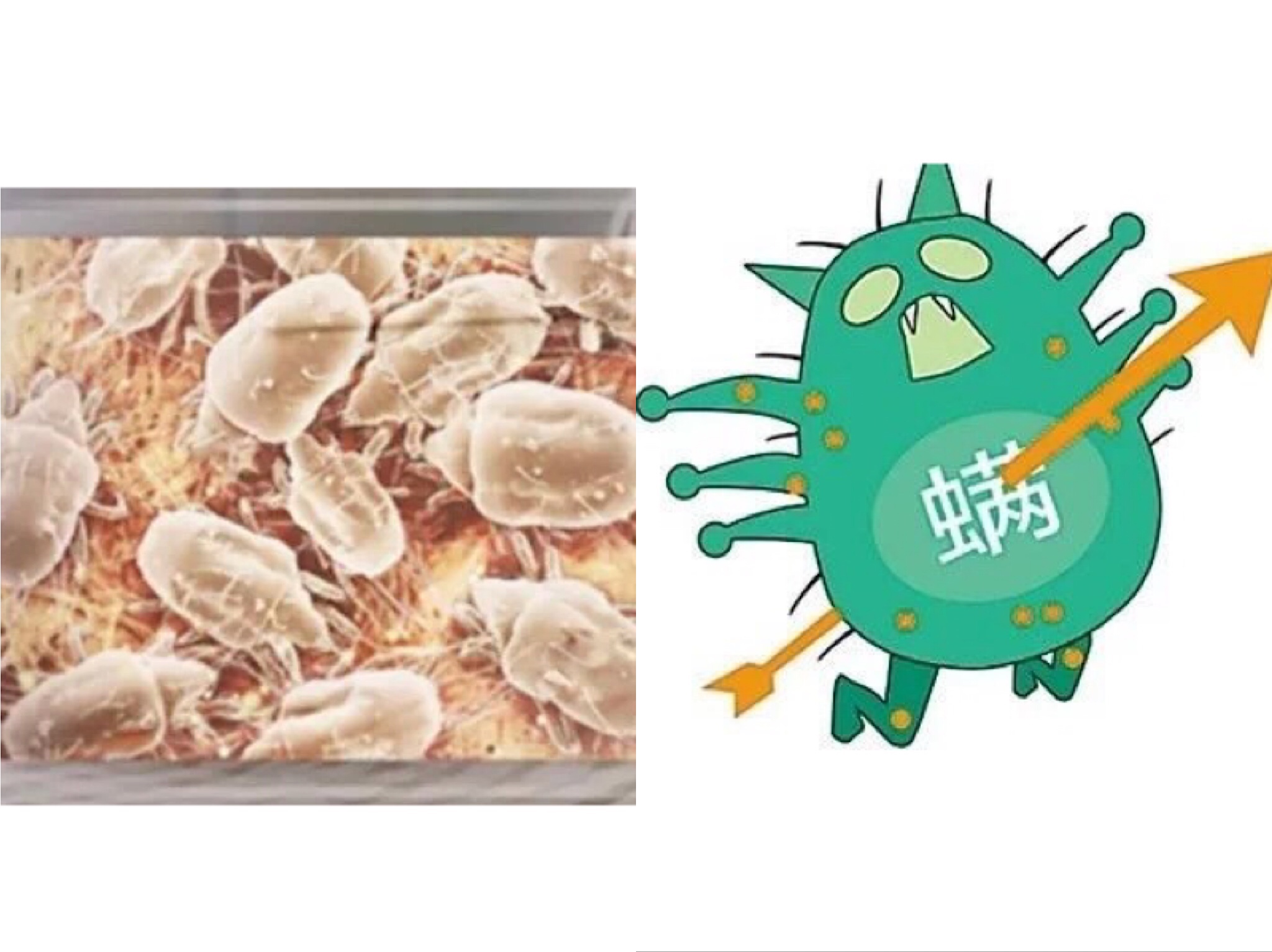 脸部除螨最有效的方法,眼睛除螨最有效的方法