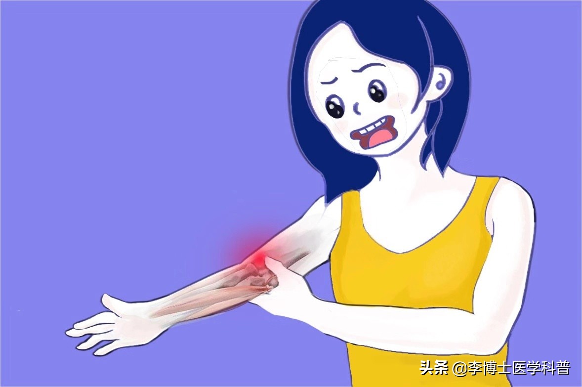 原创漫画教你八种方法治疗“网球肘”-----给你带来不一样的疗效