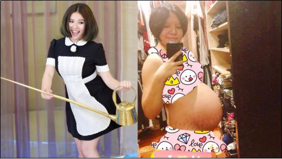 肥胖纹很严重怎么消除,有效去除肥胖纹的方法